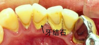 答案是肯定的